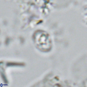 Homozygosphaera schilleri VR 08777