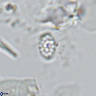 Homozygosphaera schilleri VR 08779