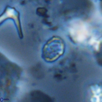 Homozygosphaera schilleri VR 08787