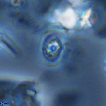 Homozygosphaera schilleri VR 08788
