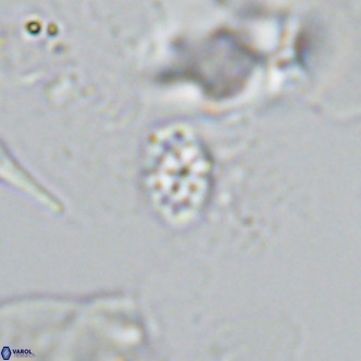 Homozygosphaera schilleri VR 08781