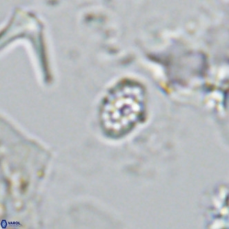 Homozygosphaera schilleri VR 08782