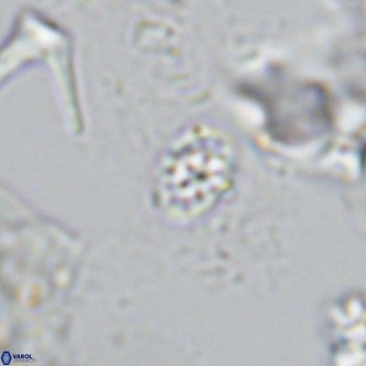 Homozygosphaera schilleri VR 08783