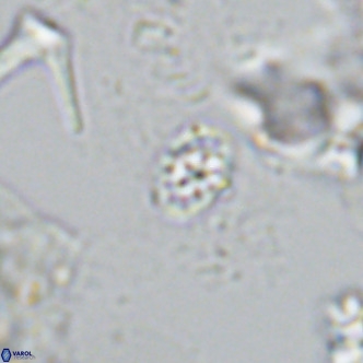 Homozygosphaera schilleri VR 08783