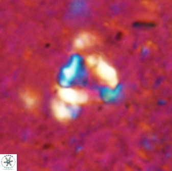 Holodiscolithus biskayae 49648