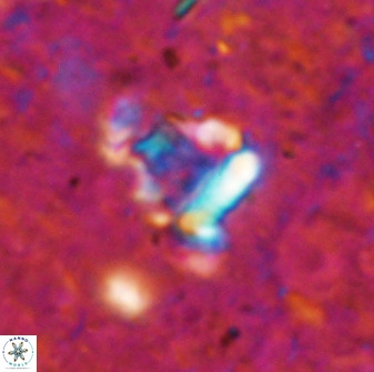 Holodiscolithus biskayae 49650