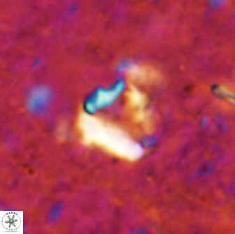 Holodiscolithus biskayae 49651