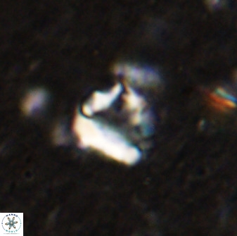 Holodiscolithus biskayae 49652