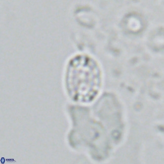 Holodiscolithus macroporus VR 09240