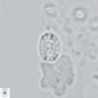 Holodiscolithus macroporus VR 09240