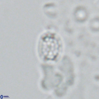 Holodiscolithus macroporus VR 09241