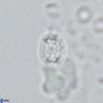 Holodiscolithus macroporus VR 09241
