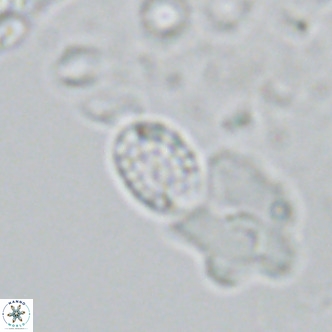 Holodiscolithus macroporus VR 09242