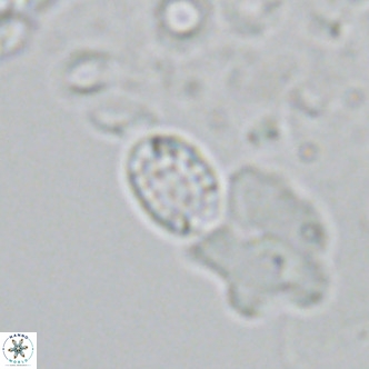 Holodiscolithus macroporus VR 09244