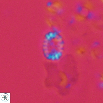 Holodiscolithus macroporus VR 09250