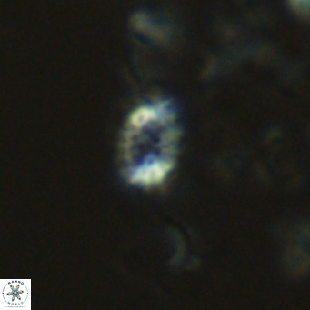 Holodiscolithus macroporus VR 09252
