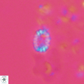 Holodiscolithus macroporus VR 09256