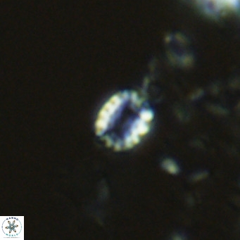Holodiscolithus macroporus VR 09257