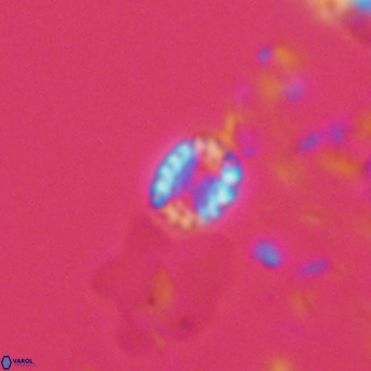 Holodiscolithus macroporus VR 09258