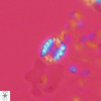 Holodiscolithus macroporus VR 09258