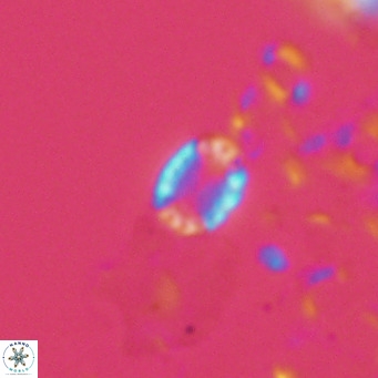 Holodiscolithus macroporus VR 09259