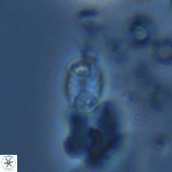 Holodiscolithus macroporus VR 09264