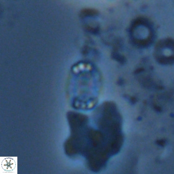 Holodiscolithus macroporus VR 09265