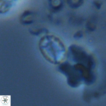 Holodiscolithus macroporus VR 09268