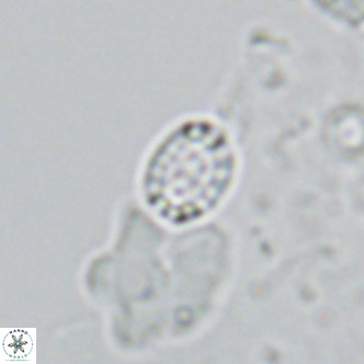 Holodiscolithus macroporus VR 09238