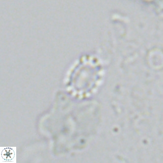 Holodiscolithus macroporus VR 09239