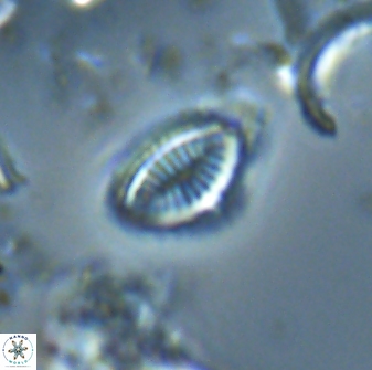 Hornibrookina australis 19956
