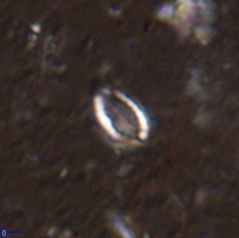 Hornibrookina australis arca 49185