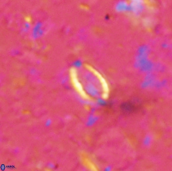 Hornibrookina australis arca 49186