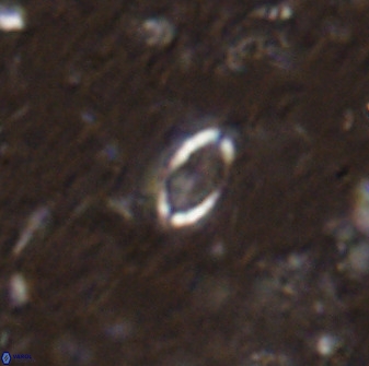 Hornibrookina australis arca 49196