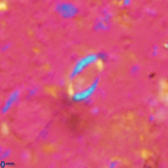 Hornibrookina australis arca 49197