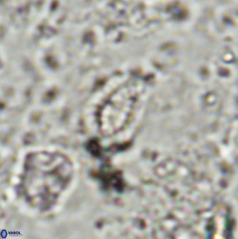 Hornibrookina australis arca 49191