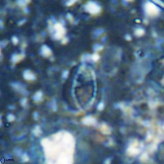 Hornibrookina australis arca 49193