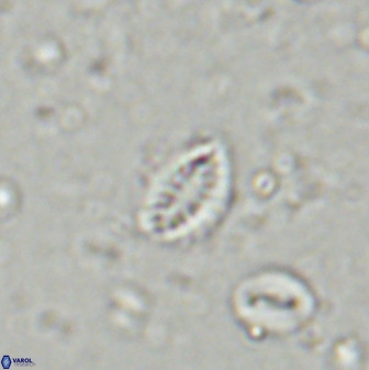 Hornibrookina australis arca 49379