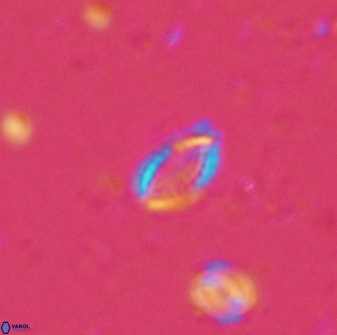 Hornibrookina australis arca 49371
