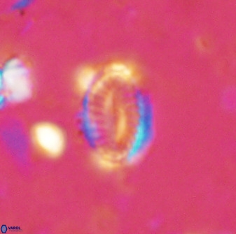 Hornibrookina teuriensis 50339