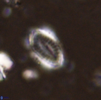Hornibrookina teuriensis 50341