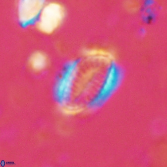 Hornibrookina teuriensis 50343