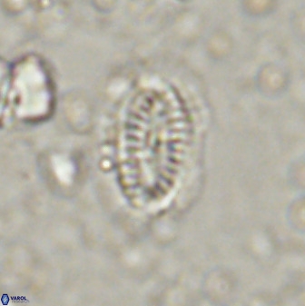 Hornibrookina teuriensis 50345