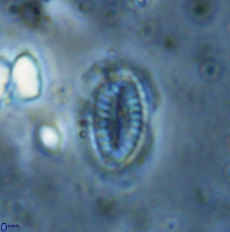 Hornibrookina teuriensis 50346