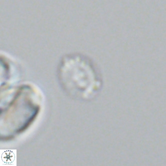 Hughesius gizoensis VR 09834