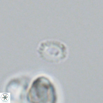 Hughesius gizoensis VR 09835