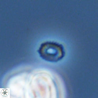 Hughesius gizoensis VR 09836