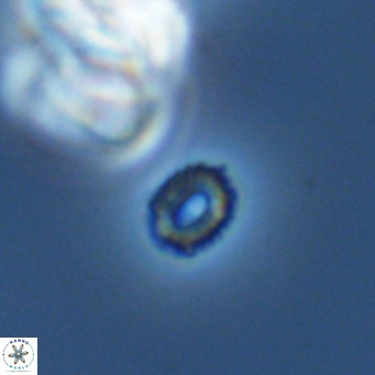 Hughesius gizoensis VR 09839