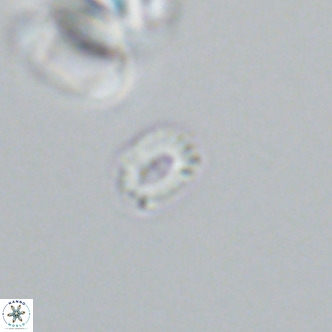 Hughesius gizoensis VR 09831