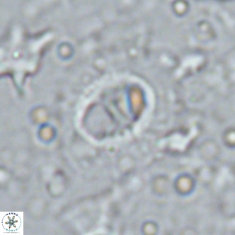 Hughesius synchysi VR 16613